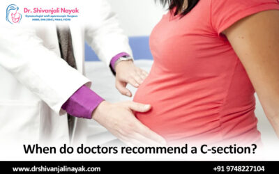 When do doctors recommend a C-section?