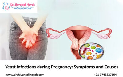 Yeast Infections During Pregnancy: Symptoms and Causes
