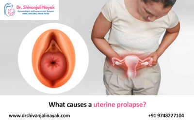 What causes a uterine prolapse?