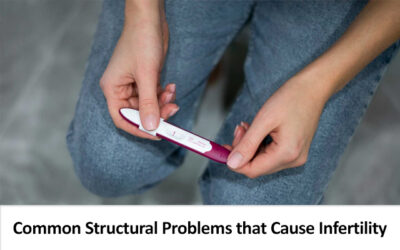 Common Structural Problems that Cause Infertility