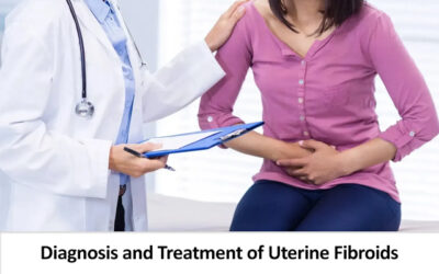 Diagnosis and Treatment of Uterine Fibroids