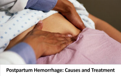 Postpartum Hemorrhage: Causes and Treatment