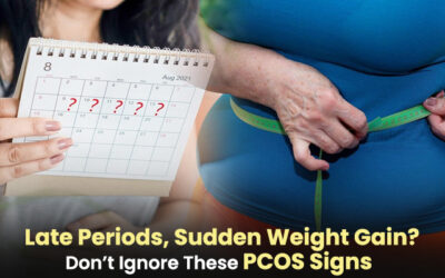 Late Periods, Sudden Weight Gain? Don’t Ignore These PCOS Signs