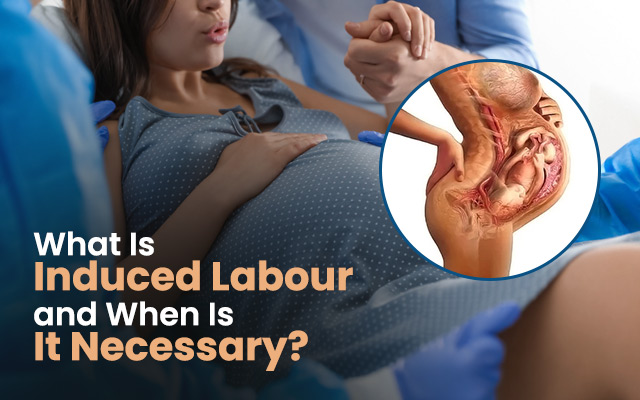 induce labour